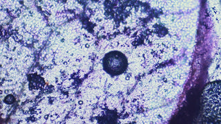 Microscopic view of a biological sample with purple and blue staining